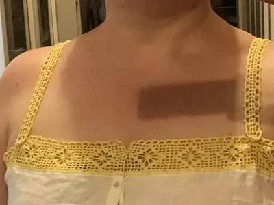 Spider Web Yoke