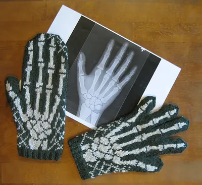 X-Ray